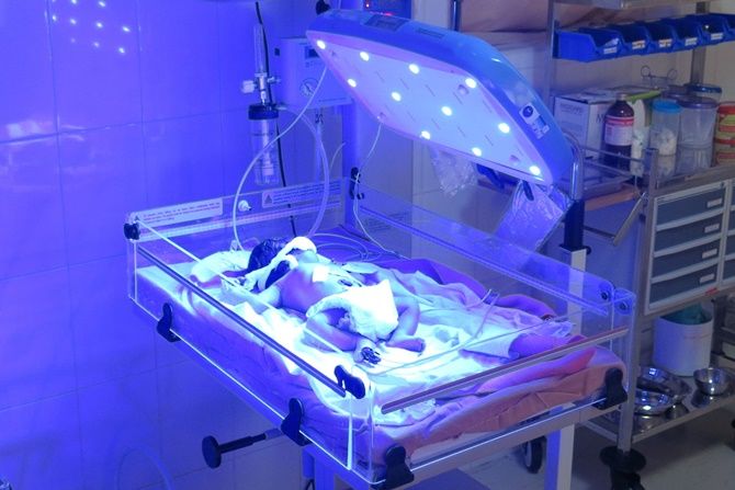 fototerapia-neonatal
